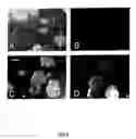 Fig. 09 - Cryopreservation of pluripotent stem cells