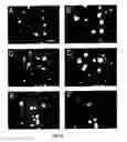Fig. 11 - Cryopreservation of pluripotent stem cells