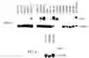 Fig. 05 - DLC-1 gene deleted in cancers