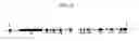 Fig. 06 - DLC-1 gene deleted in cancers