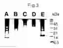 Fig. 04 - Search for cancer markers by a novel screening method