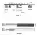Fig. 02 - Differentially expressed genes in prostate cancer