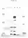 Fig. 03 - Mite galectin