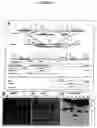 Fig. 02 - Process for xylanase production