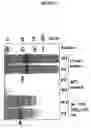 Fig. 04 - Process for xylanase production