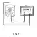 Fig. 02 - Methods and compositions for treating hyperlipemia