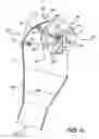 Fig. 06 - Dedagging implement and rotor thereof