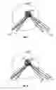 Fig. 02 - Conformable resistance training device