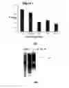 Fig. 03 - Novel protein capable of inhibiting anthrax toxin activity