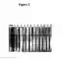 Fig. 04 - Novel protein capable of inhibiting anthrax toxin activity