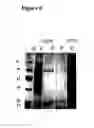 Fig. 06 - Novel protein capable of inhibiting anthrax toxin activity