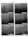 Fig. 06 - Isolated peptide of the hepatocyte growth factor and its variants, preparation method and therapeutic use as anti-angiogenic agents
