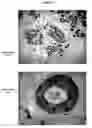 Fig. 08 - Tumour suppressor gene
