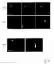 Fig. 09 - Agent for inhibiting development or progress of proliferative diseases and especially cancer diseases and pharmaceutical composition containing said agent
