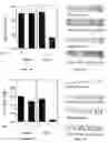 Fig. 03 - Cardiac arrhythmia treatment methods