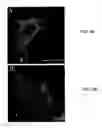 Fig. 05 - Method for reducing overproduction of neuropeptide Y in an individual