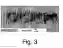 Fig. 04 - Processes for preparing novel methylene blue derivative