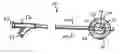 Fig. 01 - Drug eluting brachytherapy methods and apparatus