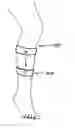 Fig. 01 - Apparatus and method for controlling blood circulation using a magnetic field