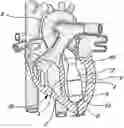 Fig. 01 - Dual inlet mixed-flow blood pump