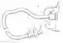 Fig. 01 - Methods and devices for diagnostic and therapeutic interventions in the peritoneal cavity