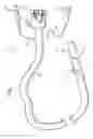 Fig. 02 - Methods and devices for diagnostic and therapeutic interventions in the peritoneal cavity
