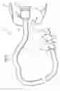Fig. 03 - Methods and devices for diagnostic and therapeutic interventions in the peritoneal cavity