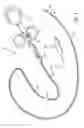 Fig. 04 - Methods and devices for diagnostic and therapeutic interventions in the peritoneal cavity