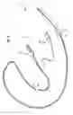 Fig. 06 - Methods and devices for diagnostic and therapeutic interventions in the peritoneal cavity