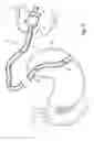 Fig. 07 - Methods and devices for diagnostic and therapeutic interventions in the peritoneal cavity