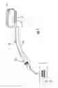 Fig. 02 - Device for sealing a body canal and method of use