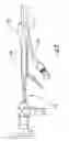 Fig. 04 - Device for sealing a body canal and method of use