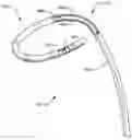 Fig. 01 - Methods of catheterization using a dual steer preshaped catheter