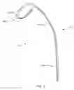 Fig. 02 - Methods of catheterization using a dual steer preshaped catheter
