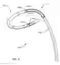 Fig. 04 - Methods of catheterization using a dual steer preshaped catheter