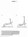 Fig. 03 - Magnetic resonance spectroscopy to classify tissue