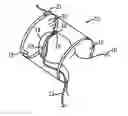 Fig. 01 - Motion sensing MRI local coil