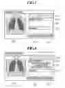 Fig. 08 - Medical image interpretation system and interpretation report generating method