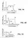 Fig. 07 - Methods for digital bowel subtraction and polyp detection