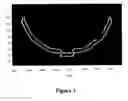 Fig. 04 - Tissue sensing adaptive radar imaging for breast tumor detection