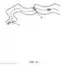 Fig. 07 - System and method for polyp visualization