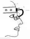 Fig. 01 - Method and arrangement for optically measuring swelling of the nose