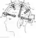Fig. 01 - Methods and apparatus for positioning and retrieving information from a plurality of brain activity sensors