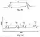 Fig. 08 - Method and system for examining tissue according to the dielectric properties thereof