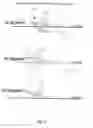 Fig. 02 - Cervical traction device