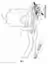 Fig. 04 - Cervical traction device