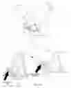 Fig. 09 - Cervical traction device