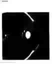 Fig. 02 - Ocular pressure regulation