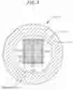 Fig. 06 - Bidirectional steerable catheter with slidable mated puller wires