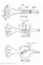 Fig. 37 - Occludable intravascular catheter for drug delivery and method of using the same